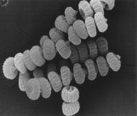 Sporen von Aspergillus niger