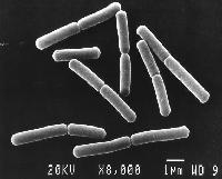 Elektronenmikroskopische Aufnahme von Bacillus subtilis