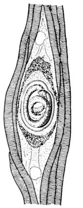 Muskeltrichine